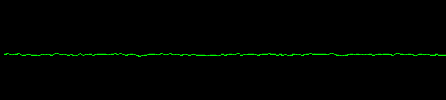 EKG asystole